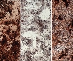 Changes in epigenome responsible for reduced stem cell function upon aging