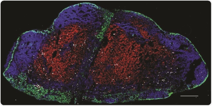 Novel T cells reside in lymph nodes and offer protection against melanoma
