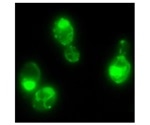 Prions may help yeast cope with rapidly changing environmental conditions