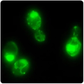 Prions may help yeast cope with rapidly changing environmental conditions