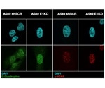 Tumor suppressor protein binding to RNA also binds DNA, says study