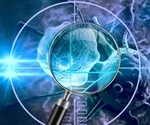 Study imparts mechanistic understanding on early stages of human cancer