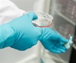 New approach to identify molecular targets for improved prostate cancer therapy
