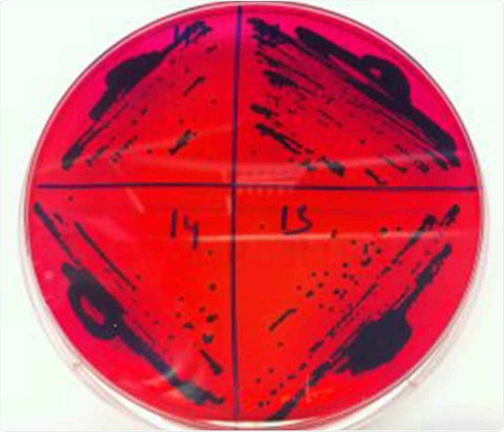 Drug-resistant Salmonella serovar Enteritidis genome sequenced by experts