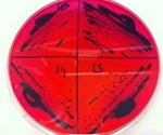 Drug-resistant Salmonella serovar Enteritidis genome sequenced by experts