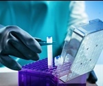 Insight into Biobanking
