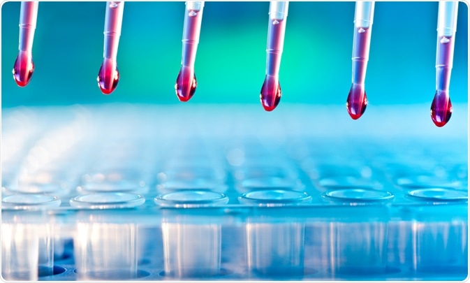 DNA Analysis DNA Analysis