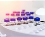 What is Green Chromatography?