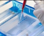 Electrophoresis: An Overview