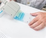 Role of Antibodies in Diagnostics