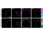Study details how cancer cells hijack the metabolic activity of non-cancer cells
