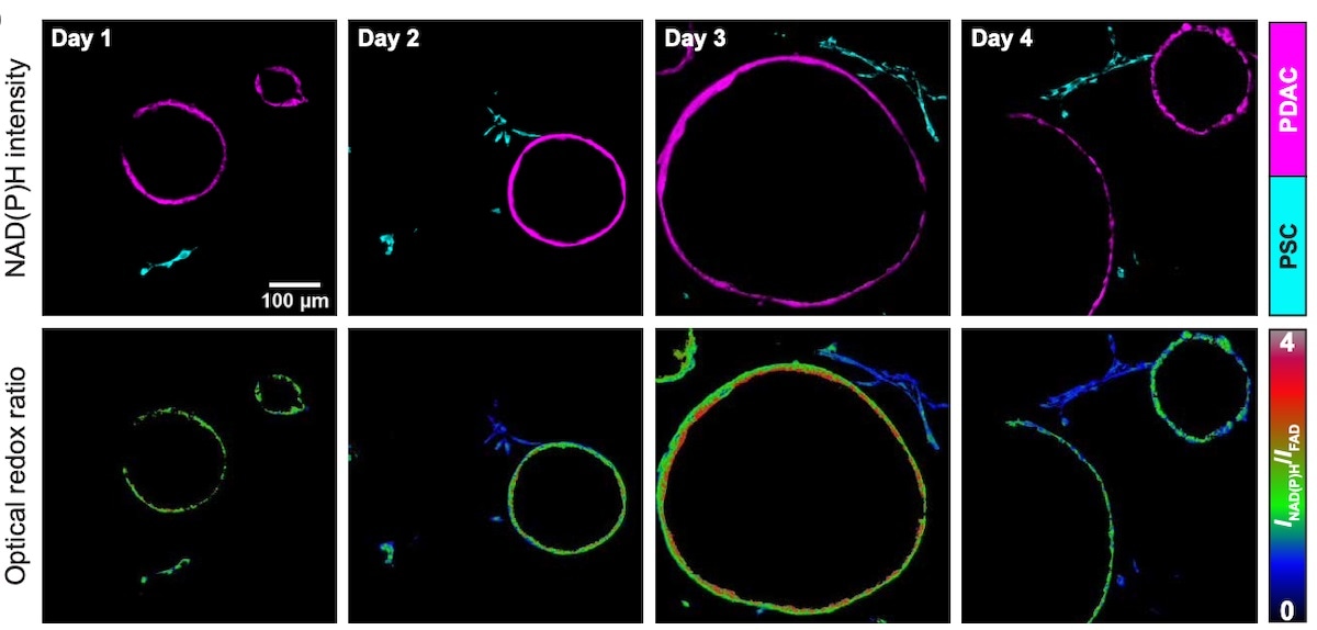 Study details how cancer cells hijack the metabolic activity of non-cancer cells