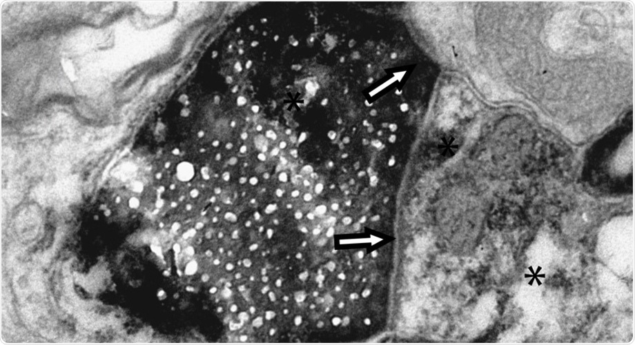 Experts unravel a new form of communication between brain cells