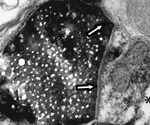 Experts unravel a new form of communication between brain cells