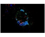 Researchers discover a molecular mechanism linked with cholesterol movement