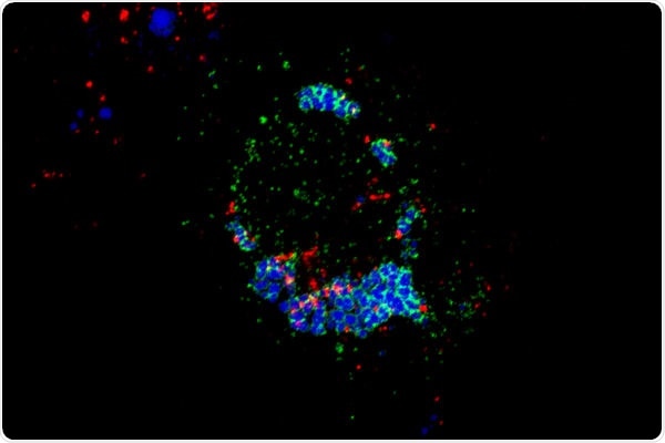 Researchers discover a molecular mechanism linked with cholesterol movement