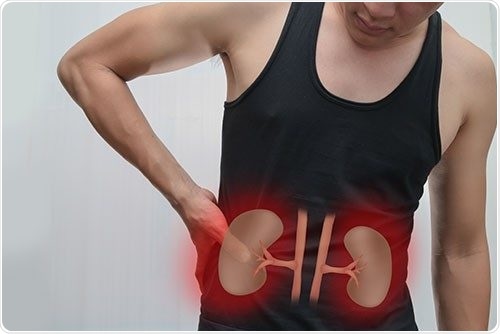 Experts develop Immuno-CRISPR assay to detect kidney transplant complications