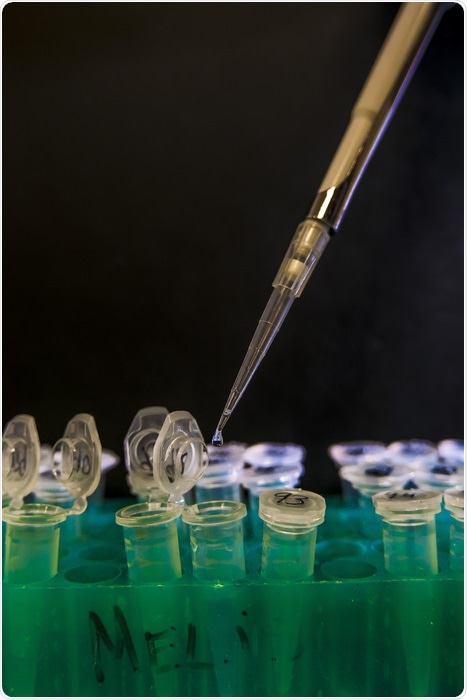Experts introduce new gene therapy approach for muscle weakness