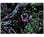 Researchers catalog the complete cells that form the blood vessels of the human brain