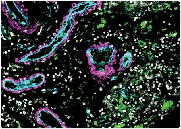 Researchers catalog the complete cells that form the blood vessels of the human brain