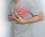 Scientists develop molecules for myocardial PET and fluorescence bimodal imaging