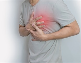 Scientists develop molecules for myocardial PET and fluorescence bimodal imaging