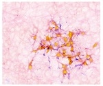 Study investigates the relationship between healthy tissue repair and cancer growth