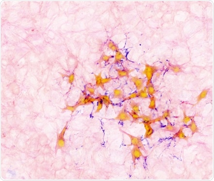 Study investigates the relationship between healthy tissue repair and cancer growth