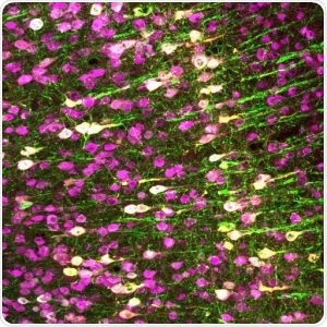 Researchers identify a sound-sensitive mammalian protein