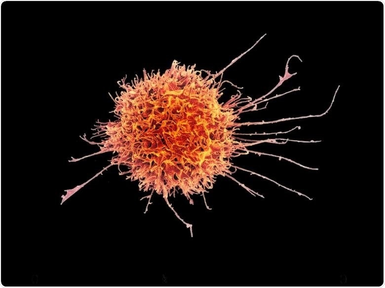 Researchers analyze how natural killer cells respond to COVID-19