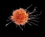Researchers analyze how natural killer cells respond to COVID-19