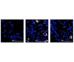 Single-cell sequencing technique helps to examine early SARS-CoV-2 infection