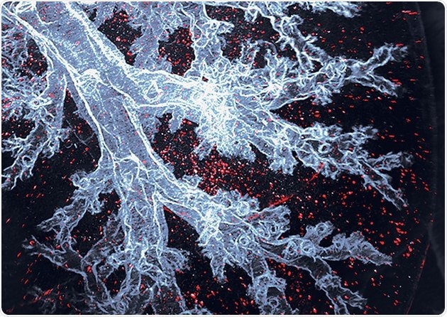 Macrophages restore normal functions when transported back to the body, says research
