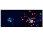 Intracellular pathogens trick the host’s immune system to evade destruction