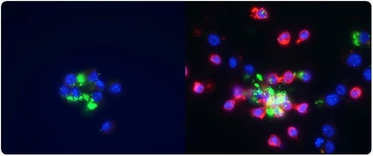 Intracellular pathogens trick the host’s immune system to evade destruction
