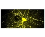 Researchers provide first evidence of the gene-environment interaction in the social dysfunctions typical of autistic disorders