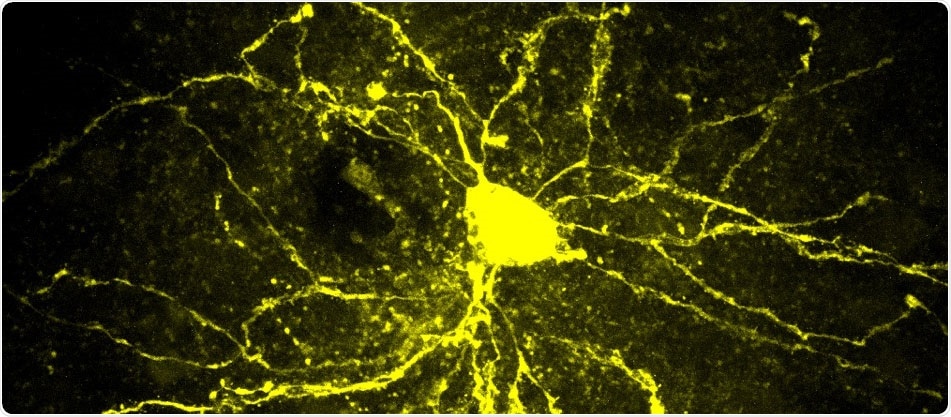 Researchers provide first evidence of the gene-environment interaction in the social dysfunctions typical of autistic disorders