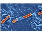 New genomic study suggests protein-based antigens provide more stable vaccine targets for Shigella