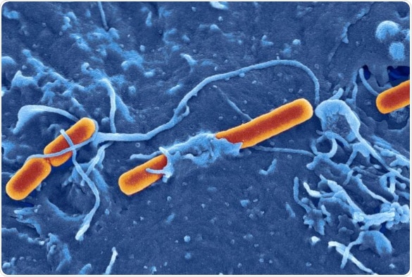 New genomic study suggests protein-based antigens provide more stable vaccine targets for Shigella