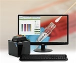 Sample management of Covid-19 cryobox tube racks