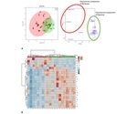 Researchers study how metabolomic assessment finds postmortem biomarkers indicating decedent’s diabetes mellitus history