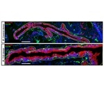 Researchers discover how pancreatic cells remodel themselves to reduce the immune response in patients at risk for T1D