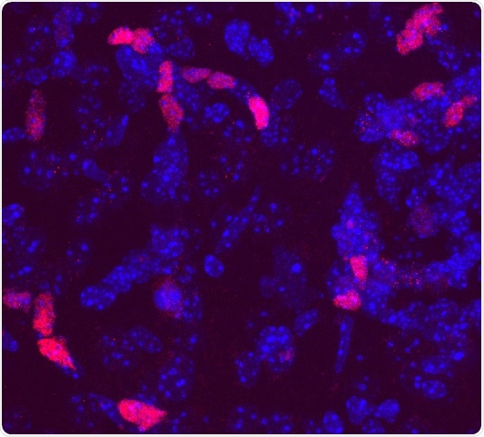 Research shows DLX2 Protein regenerate astrocytes into neural stem-like cells
