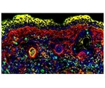 Proteins surrounding organs and tissues switch off natural killer cells’ “killer” function, study finds
