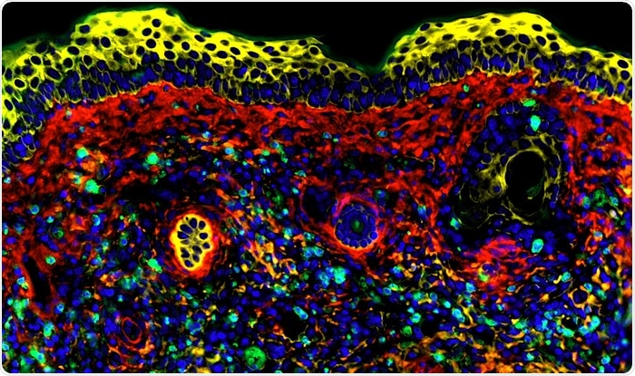 Research reveals how to boost natural killer cells target against cancer