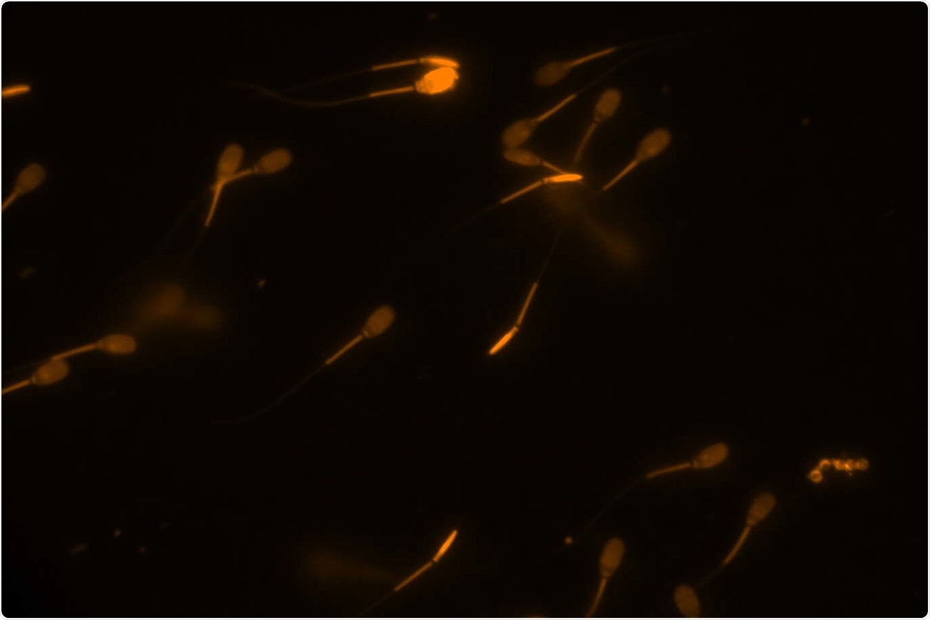 Researchers demonstrate how sperms defend their membranes from oxidation