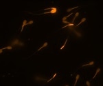 Researchers demonstrate how sperms defend their membranes from oxidation