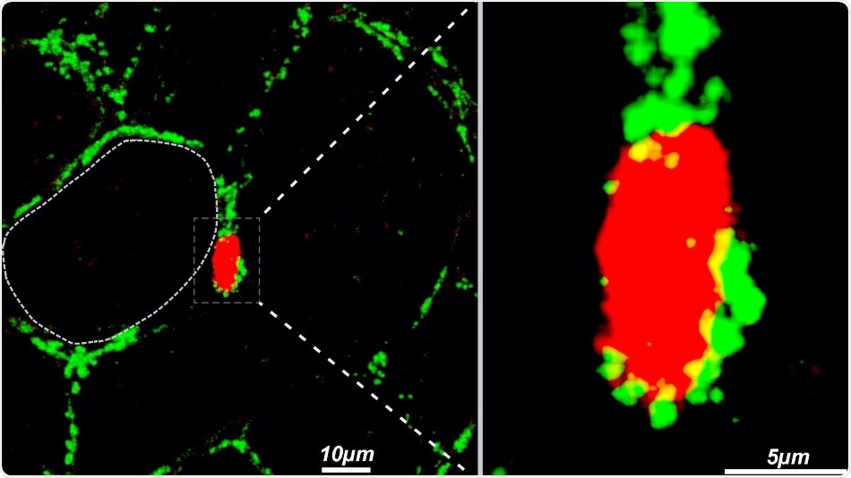 US Research reveals the role of Heparan Sulfate in obesity US Research reveals the role of Heparan Sulfate in obesity