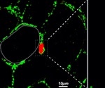 US research reveals the role of Heparan Sulfate in obesity