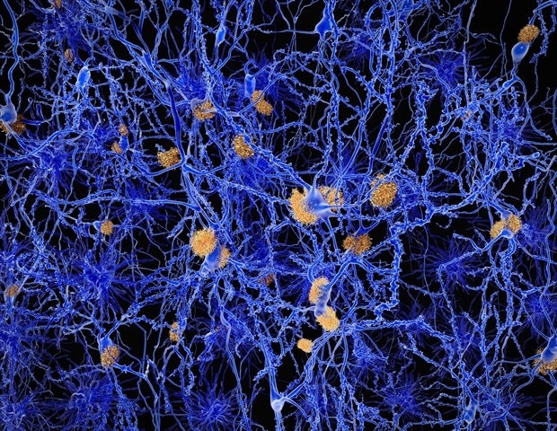 Scientists Pioneer mRNA Approach to Target Alzheimer's Protein